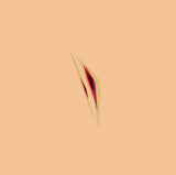 Witness Wounds