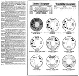 The Best Of The Electras