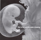 I Will Swim Into The Lazer Eye / XBXRX